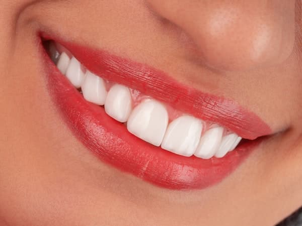 Before - Teeth Whitening